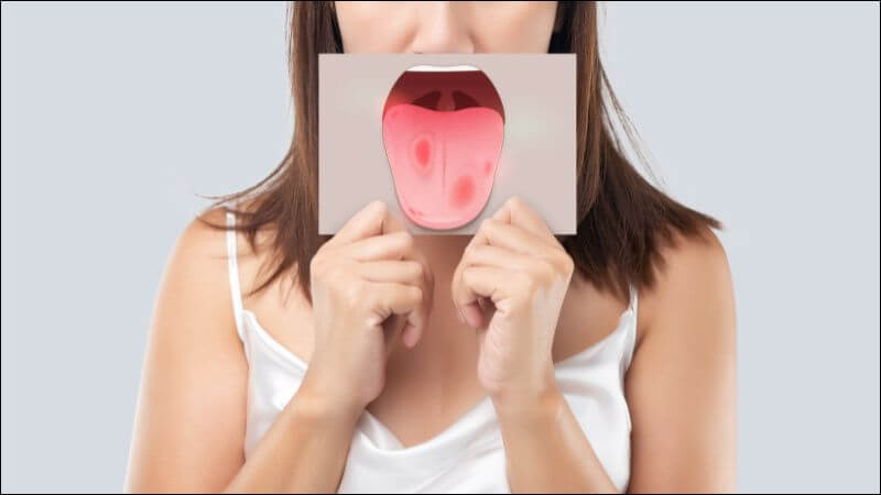 Trẻ hoặc người lớn có thể mắc lại bệnh tay chân miệng nhiều lần Trẻ hoặc người lớn có thể mắc lại bệnh tay chân miệng nhiều lần
