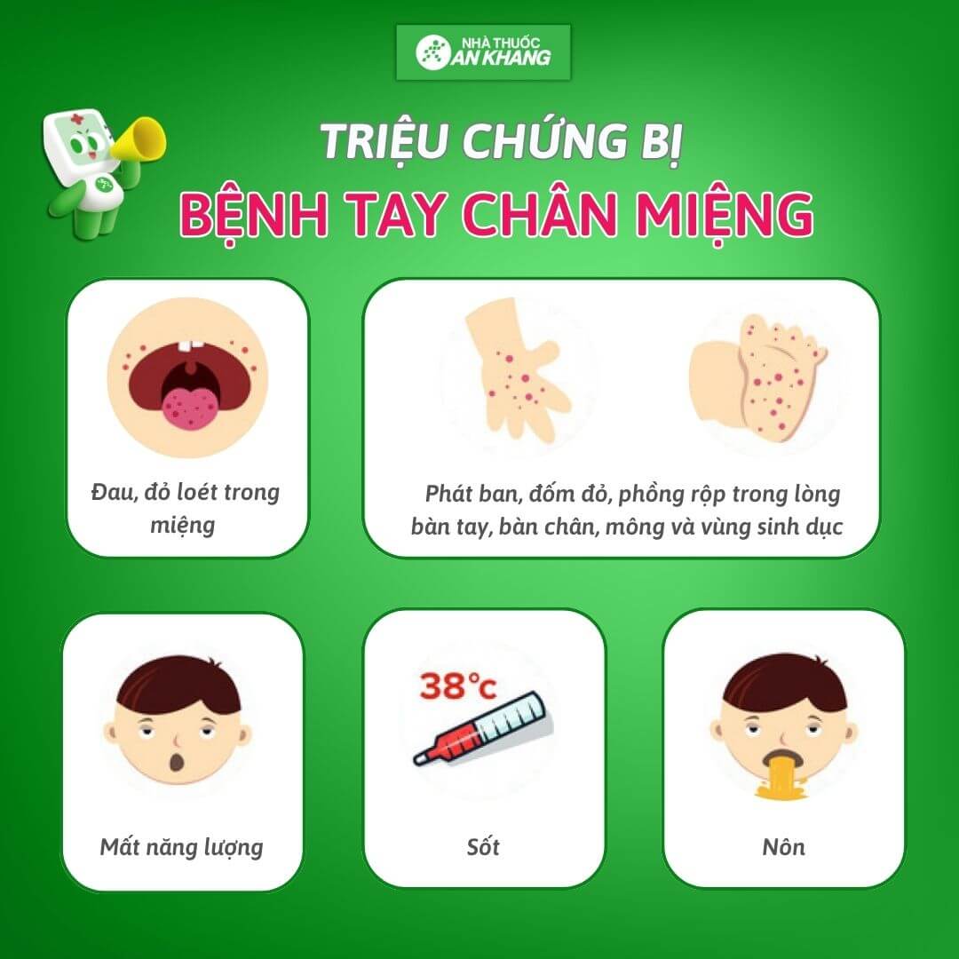 Các triệu chứng gặp của bệnh tay chân miệng như sốt cao, đau họng, cảm thấy mệt mỏi, chán ăn Các triệu chứng gặp của bệnh tay chân miệng như sốt cao, đau họng, cảm thấy mệt mỏi, chán ăn
