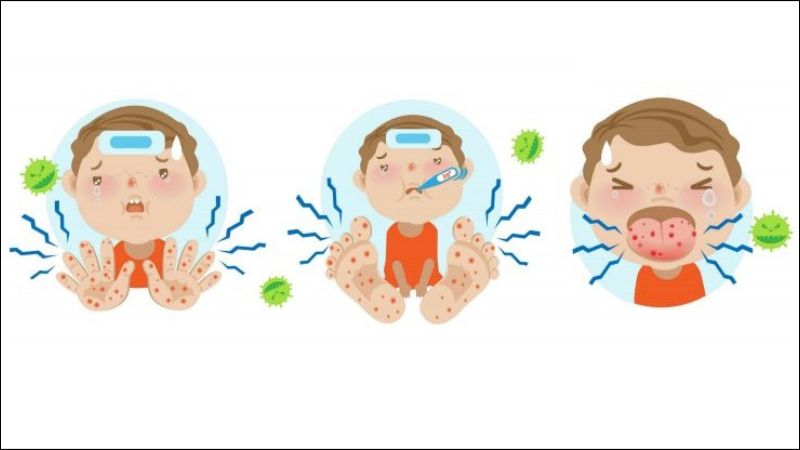 Dấu hiệu tay chân miệng ở trẻ như vã mồ hôi, lạnh toàn thân, khó thở hoặc thở nhanh, run người, nôn Dấu hiệu tay chân miệng ở trẻ như vã mồ hôi, lạnh toàn thân, khó thở hoặc thở nhanh, run người, nôn