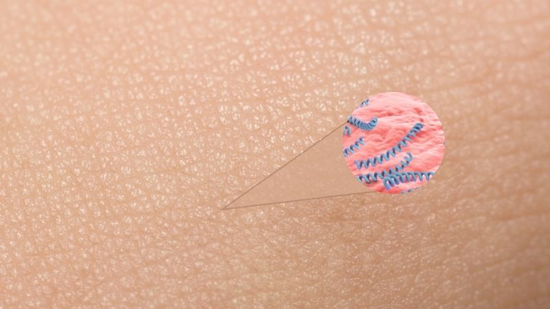 Thời gian ủ bệnh giang mai trung bình khoảng 21 ngày Thời gian ủ bệnh giang mai trung bình khoảng 21 ngày