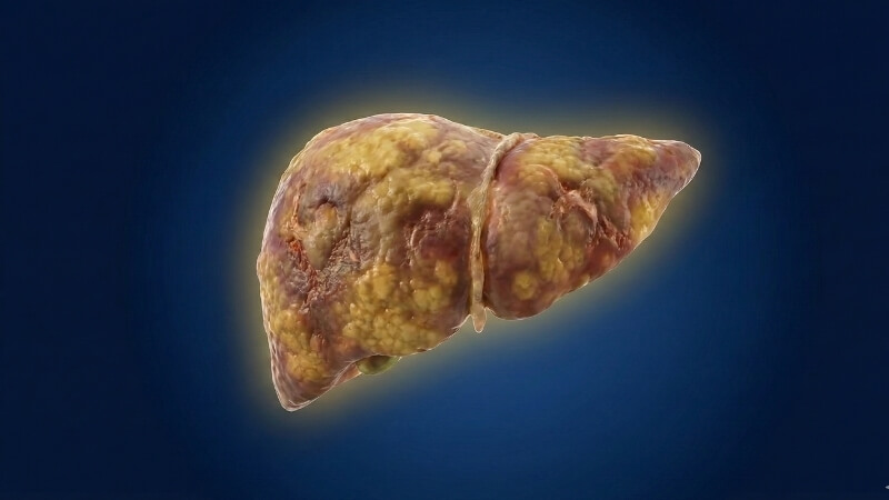 Thận trong khi d&ugrave;ng Valiera 2mg cho người suy giảm chức năng gan