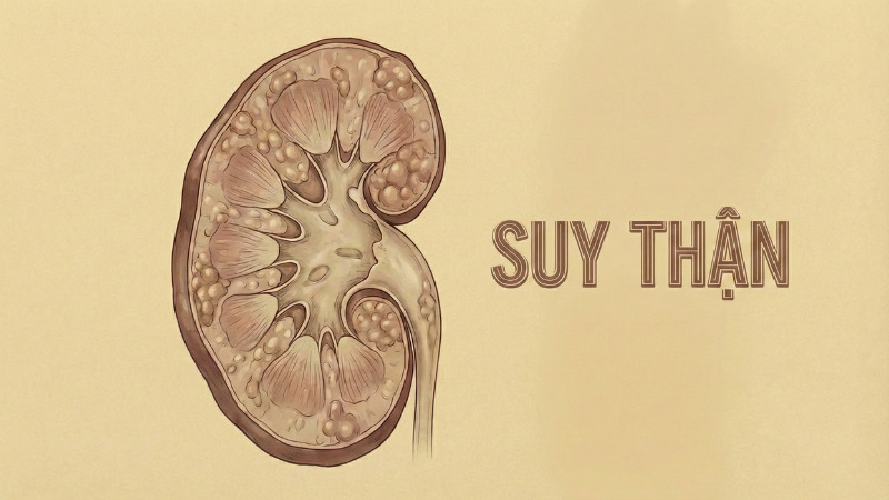 Lưu &yacute; khi d&ugrave;ng Coversyl 5mg với người bị suy thận