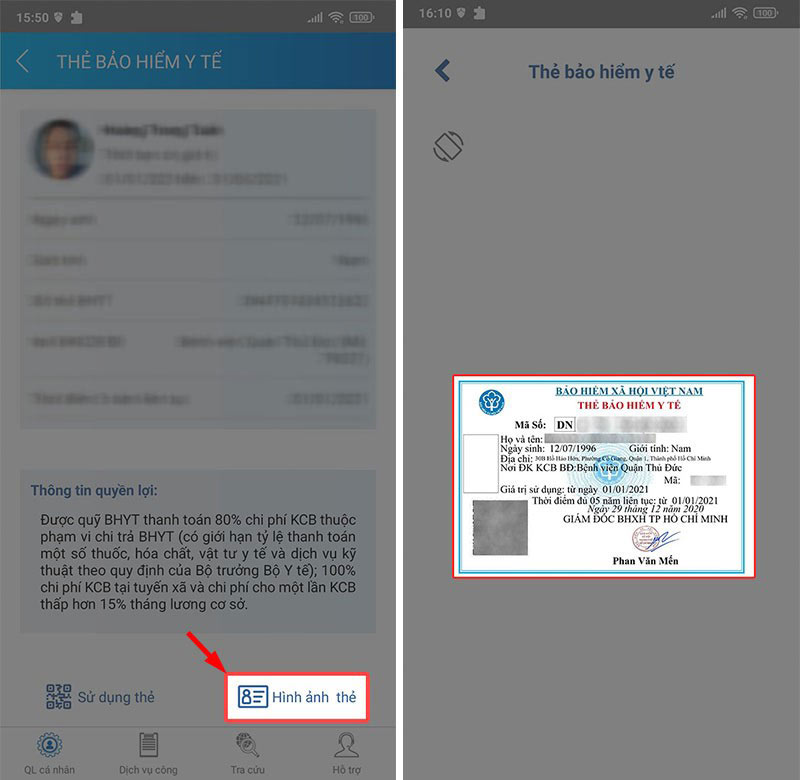 Chọn Hình ảnh thẻ