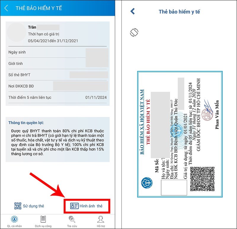 Chọn Hình ảnh thẻ