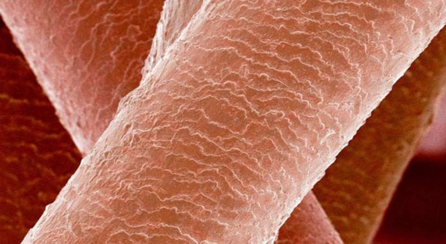 Keratin là thành phần cấu tạo nên tóc, móng và lớp biểu bì của da Keratin là thành phần cấu tạo nên tóc, móng và lớp biểu bì của da