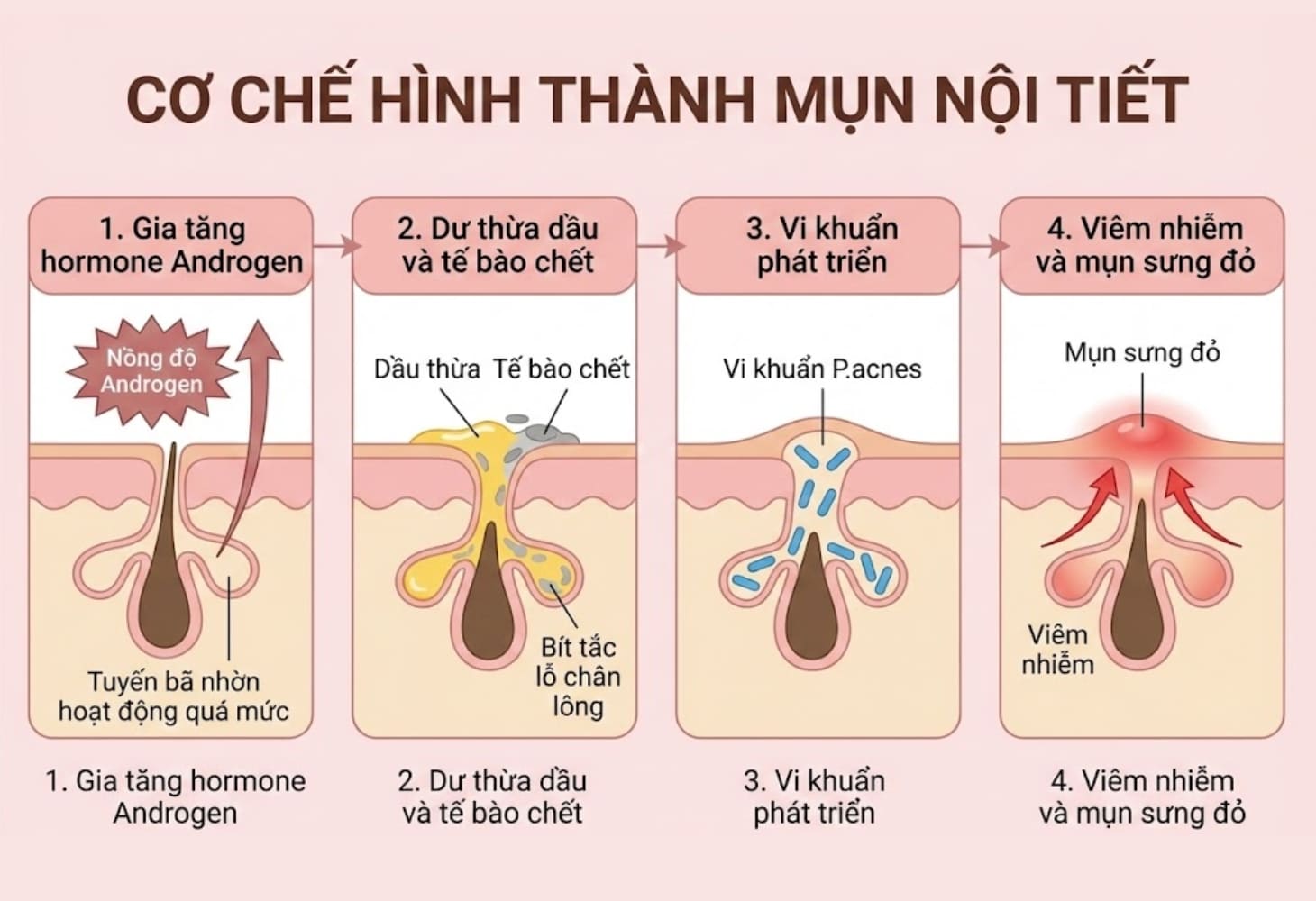 Cơ chế hình thành mụn nội tiết