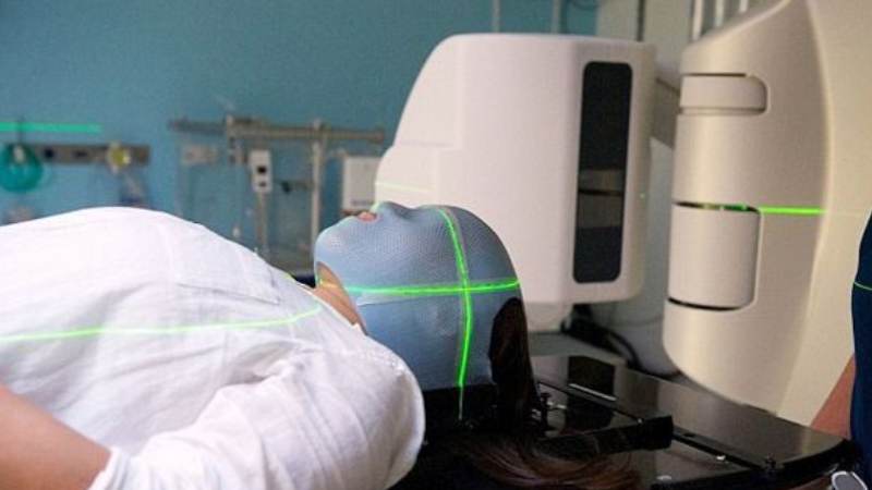 Sử dụng các tia xạ chiếu trực tiếp vào để tiêu diệt và ngăn chặn sự phân chia, xâm lấn của khối u Sử dụng các tia xạ chiếu trực tiếp vào để tiêu diệt và ngăn chặn sự phân chia, xâm lấn của khối u