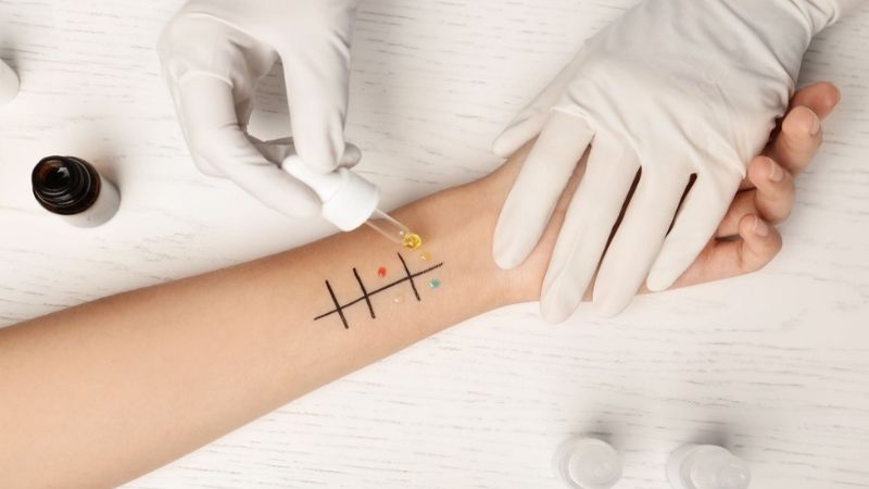 Bác sĩ có thể thực hiện test lẩy da để xác định nguyên nhân gây dị ứng Bác sĩ có thể thực hiện test lẩy da để xác định nguyên nhân gây dị ứng