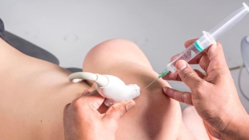 Tiêm corticoid giúp giảm đau hiệu quả Tiêm corticoid giúp giảm đau hiệu quả