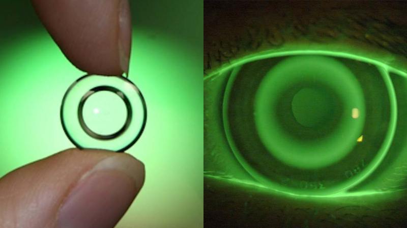 Sử dụng lens  Ortho K vào ban đêm giúp nhìn rõ hơn vào ban ngày