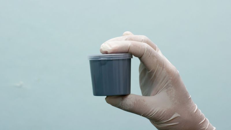 Xét nghiệm phân giúp phát hiện trứng, ấu trùng của ký sinh trùng Xét nghiệm phân giúp phát hiện trứng, ấu trùng của ký sinh trùng