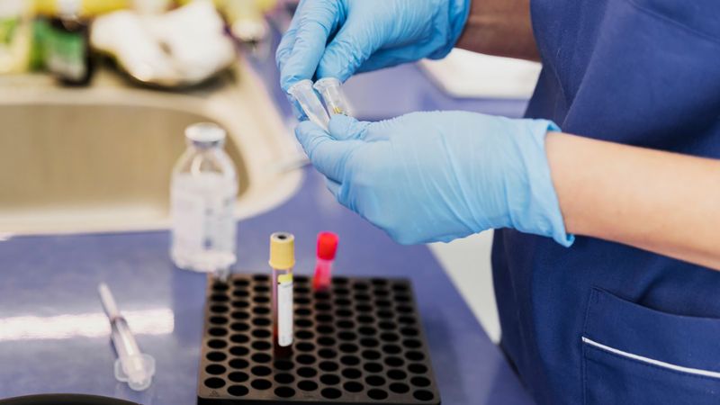 Xét nghiệm máu đặc biệt hữu ích khi ký sinh trùng ẩn nấp ở mô Xét nghiệm máu đặc biệt hữu ích khi ký sinh trùng ẩn nấp ở mô