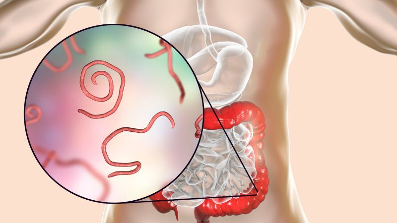 Ký sinh trùng lấy thức ăn từ niêm mạc ruột để phát triển Ký sinh trùng lấy thức ăn từ niêm mạc ruột để phát triển