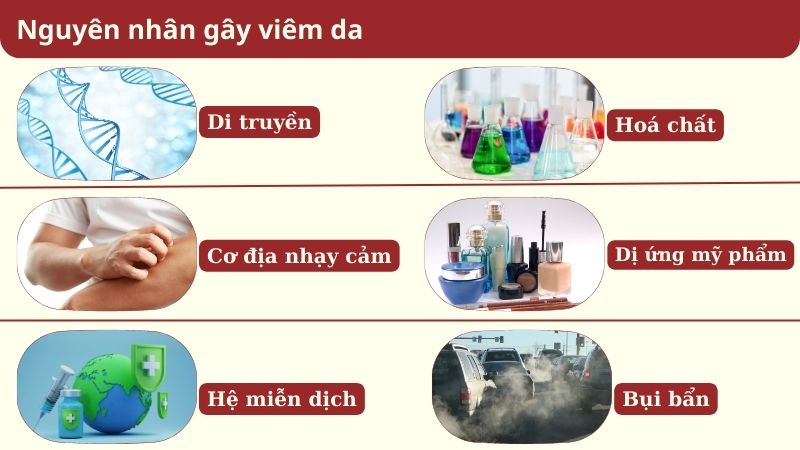 Viêm da do nhiều nguyên nhân gây nên Viêm da do nhiều nguyên nhân gây nên