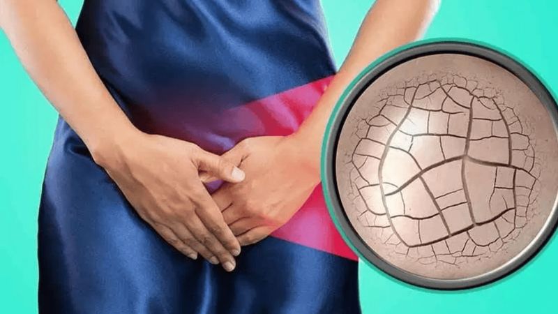 Khô âm đạo là biểu hiện thường gặp trong viêm teo âm đạo