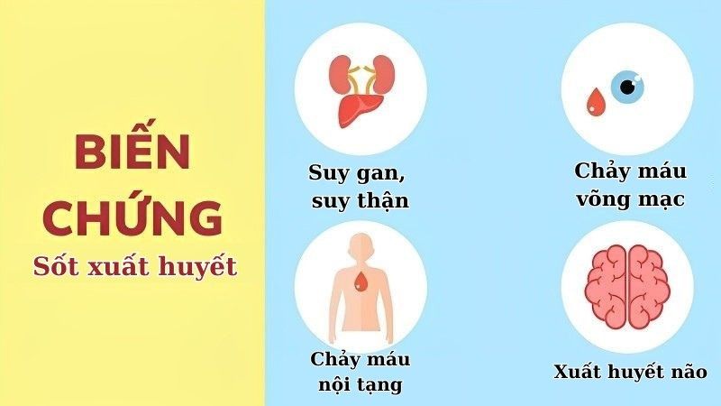 Sốt xuất huyết có thể dẫn đến nhiều biến chứng nghiêm trọng