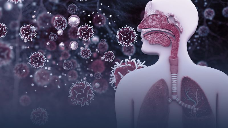 Mồ hôi lạnh có thể xuất hiện do nhiễm trùng Mồ hôi lạnh có thể xuất hiện do nhiễm trùng