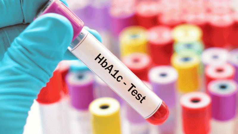 Xét nghiệm HbA1C là một xét nghiệm máu phản ánh sự kiểm soát đường huyết