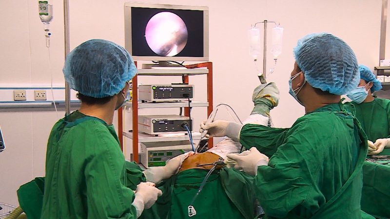 Phẫu thuật nội soi khớp vai có thể được chỉ định trong trật khớp vai tái hồi      