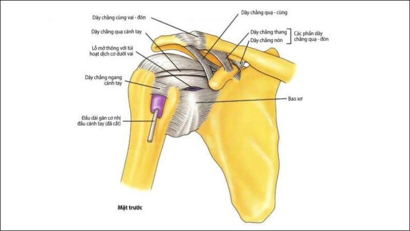 Một số người có dây chằng vai lỏng lẻo và có nguy cơ trật khớp vai tái hồi cao 