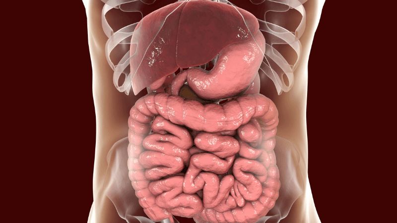 Biến chứng của thoát vị rốn Biến chứng của thoát vị rốn