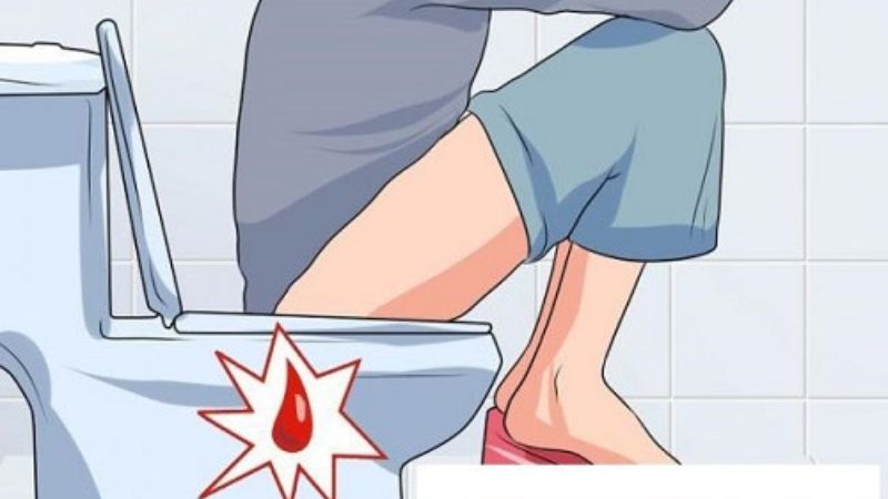 Khi xuất hiện máu trong phân, người bệnh nên đến các cơ sở y tế để được thăm khám