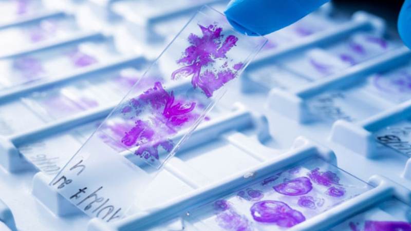 Lấy mô bệnh phẩm giúp kiểm tra sự hiện diện của virus và đánh giá giai đoạn bệnh