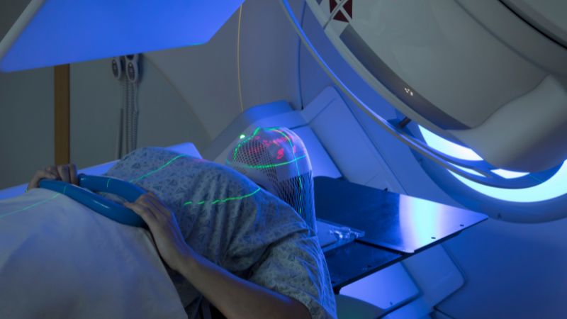Xạ trị được ứng dụng nhiều trong điều trị ung thư não Xạ trị được ứng dụng nhiều trong điều trị ung thư não