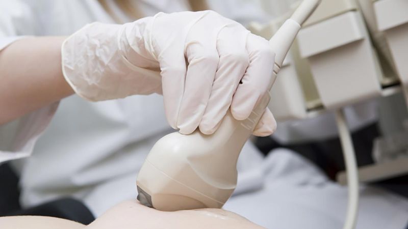 Siêu âm vú là một xét nghiệm có giá trị cao khi chẩn đoán ung thư vú ở nam giới