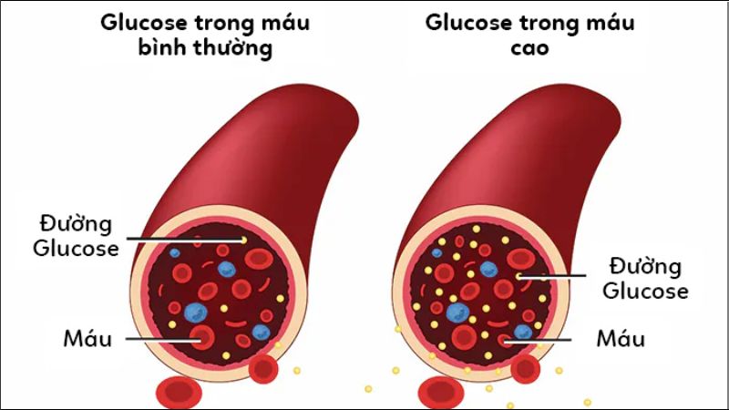 Mức glucose trong máu cao làm chậm quá trình lành vết thương tại chân