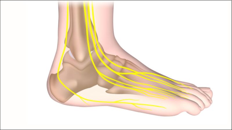 Biến chứng thần kinh do tiểu đường kéo dài khiến các dây thần kinh bị tổn thương