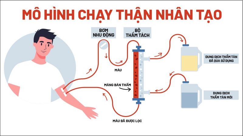 Những người đang chạy thận nhân tạo có nhiều nguy cơ thiếu hụt selen