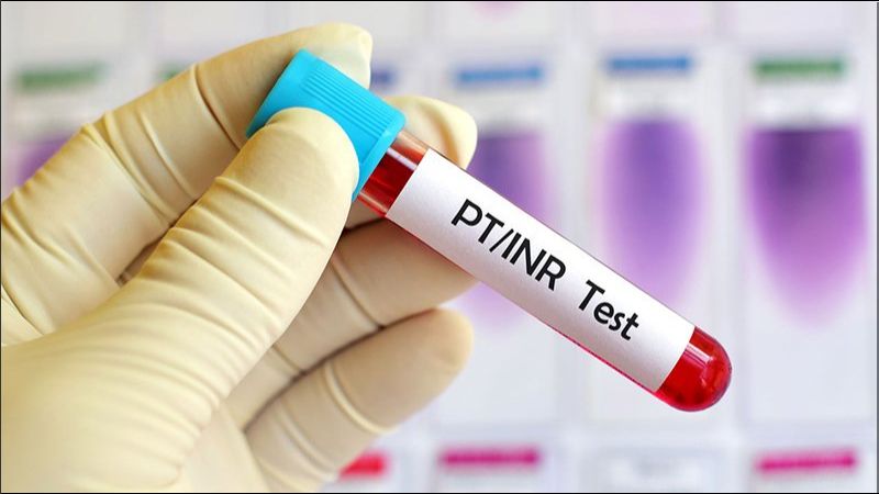 Thiếu vitamin K chẩn đoán bằng cách tiến hành xét nghiệm thời gian prothrombin (PT) Thiếu vitamin K chẩn đoán bằng cách tiến hành xét nghiệm thời gian prothrombin (PT)
