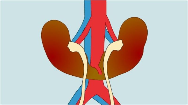 Thận móng ngựa có thể không cần điều trị nếu không gây ra triệu chứng Thận móng ngựa có thể không cần điều trị nếu không gây ra triệu chứng