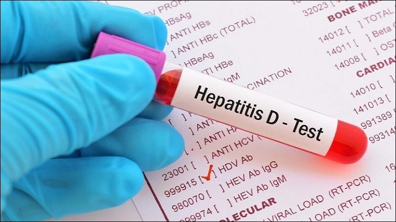 Xét nghiệm tải lượng virus HDV RNA giúp chẩn đoán viêm gan D