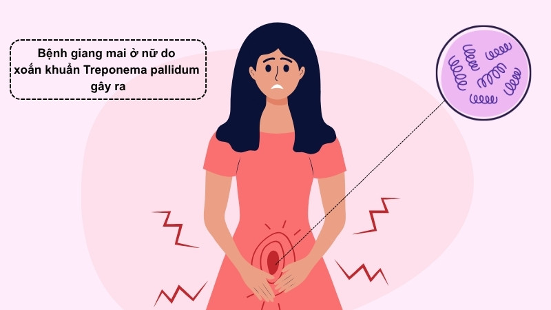 Giang mai ở nữ giới là bệnh lây truyền qua đường tình dục do xoắn khuẩn Treponema pallidum gây ra