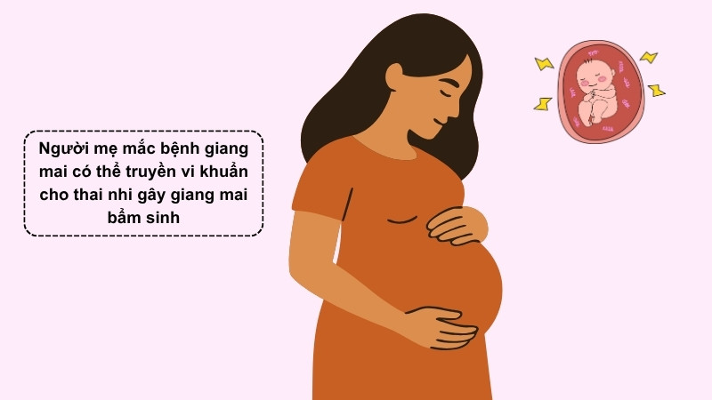 Trẻ có nguy cơ cao mắc giang mai bẩm sinh nếu mẹ nhiễm bệnh