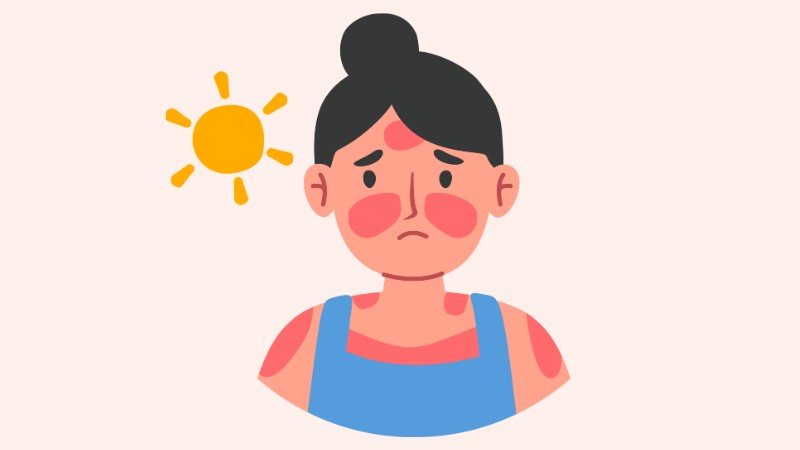 Việc tiếp xúc thường xuyên với tia cực tím khiến da dễ bị đồi mồi