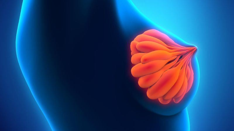 Tắc tia sữa l&agrave; t&igrave;nh trạng một hoặc nhiều ống dẫn sữa trong v&uacute; bị tắc nghẽn