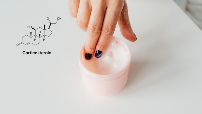 Việc lạm dụng c&aacute;c loại kem b&ocirc;i chứa corticosteroid, khiến da dễ bị k&iacute;ch ứng