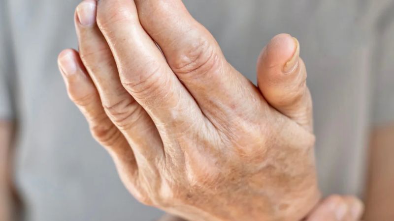 Viêm đa khớp là tình trạng viêm xảy ra cùng lúc từ 5 khớp trở lên