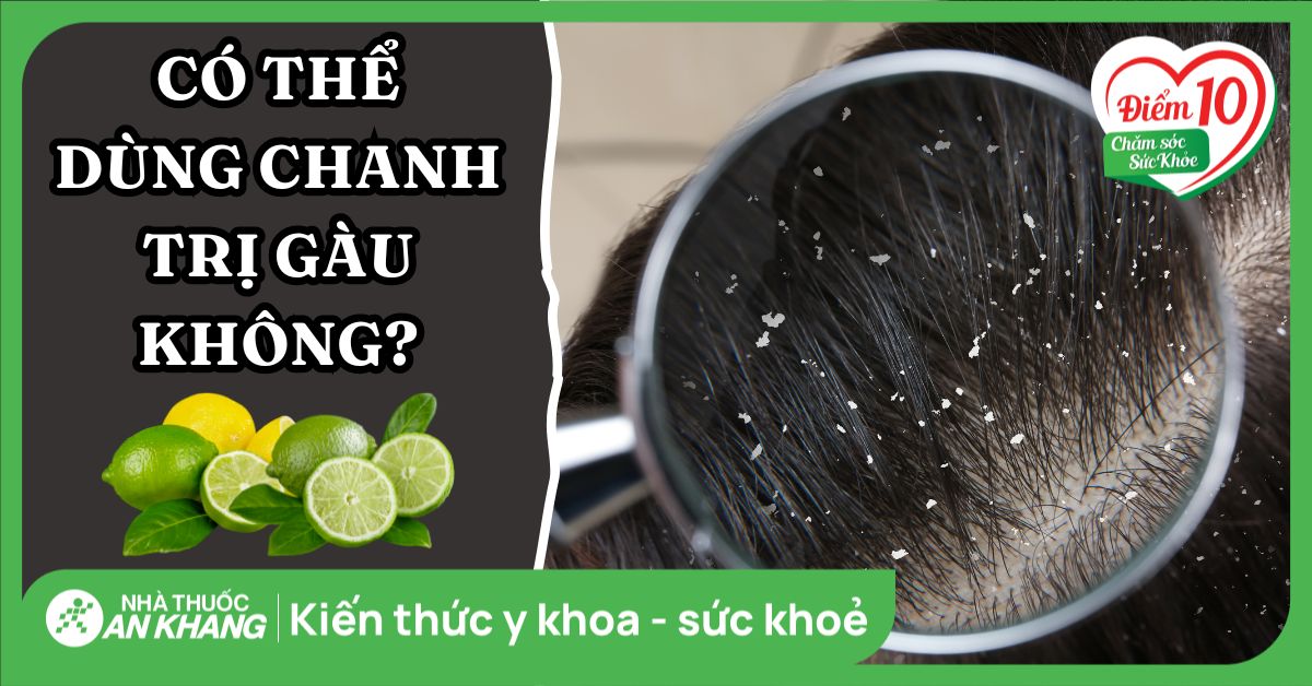 Có thể sử dụng chanh để trị gàu không?