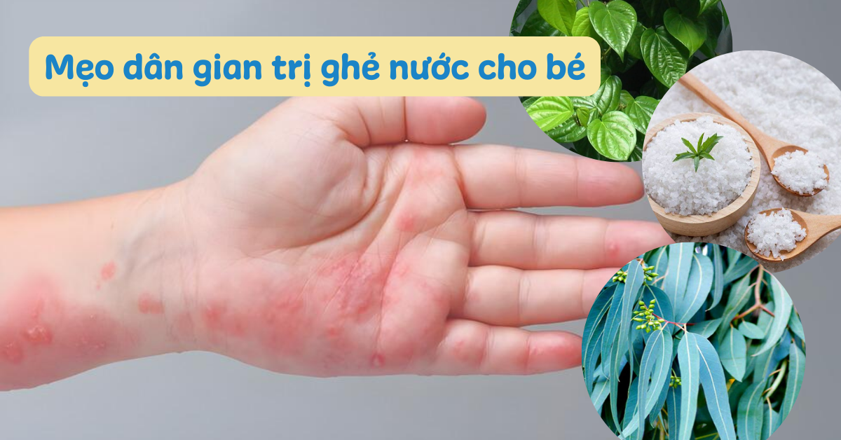 6. Những lưu ý trong việc chăm sóc da bị ghẻ nước