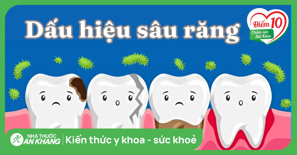 11 dấu hiệu sâu răng và các mức độ giúp bạn sớm nhận biết để điều trị