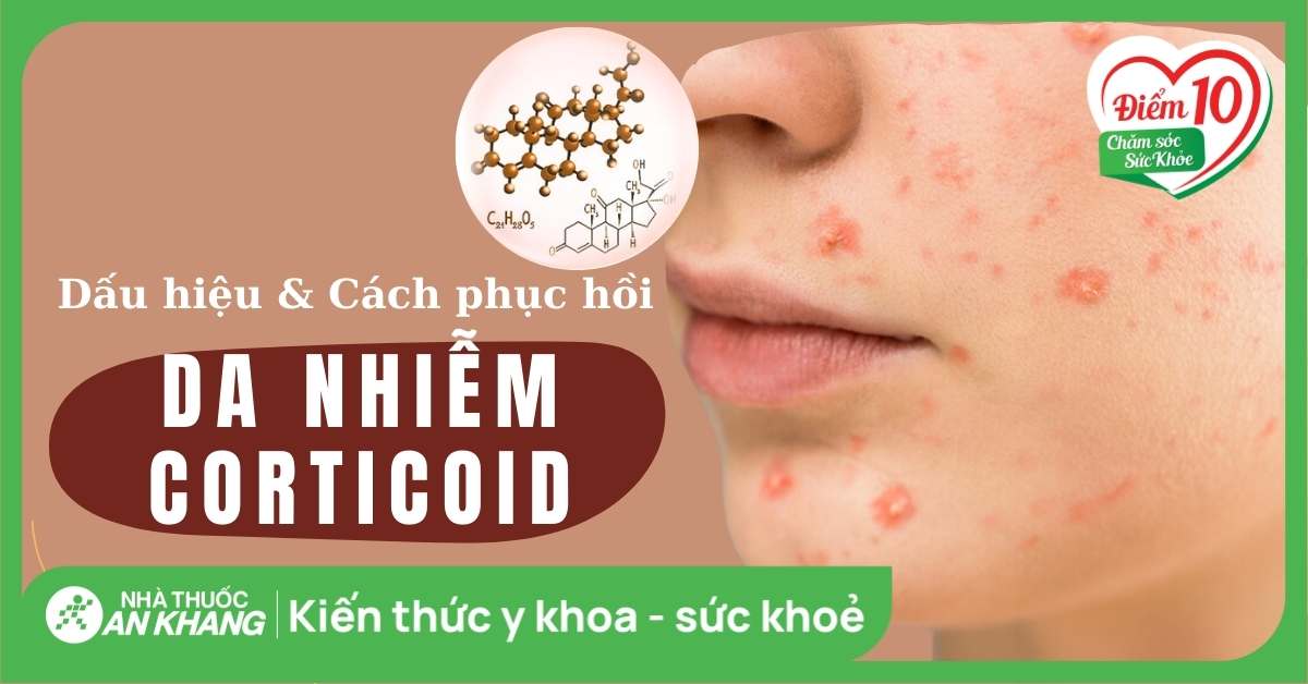 Da nhiễm corticoid là gì? 5 cấp độ dấu hiệu nhận biết và cách phục hồi