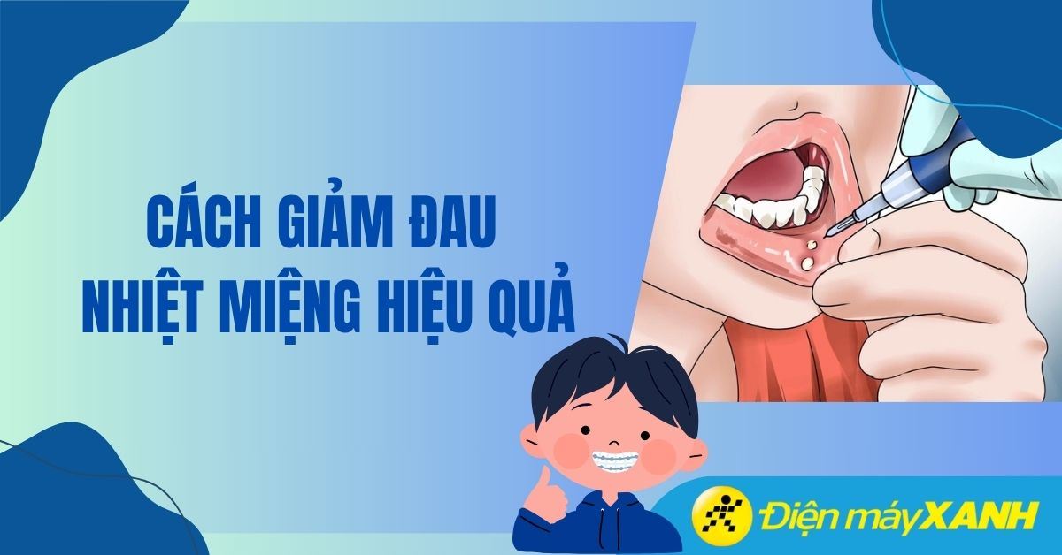 Cách giảm đau nhiệt miệng trong 1 đêm an toàn tại nhà