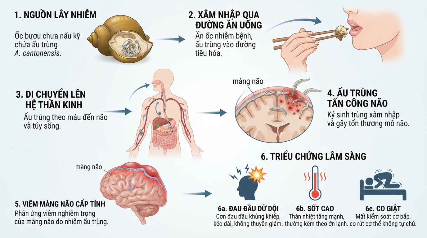 Ấu trùng giun phổi di chuyển lên não gây viêm màng não cấp tính.