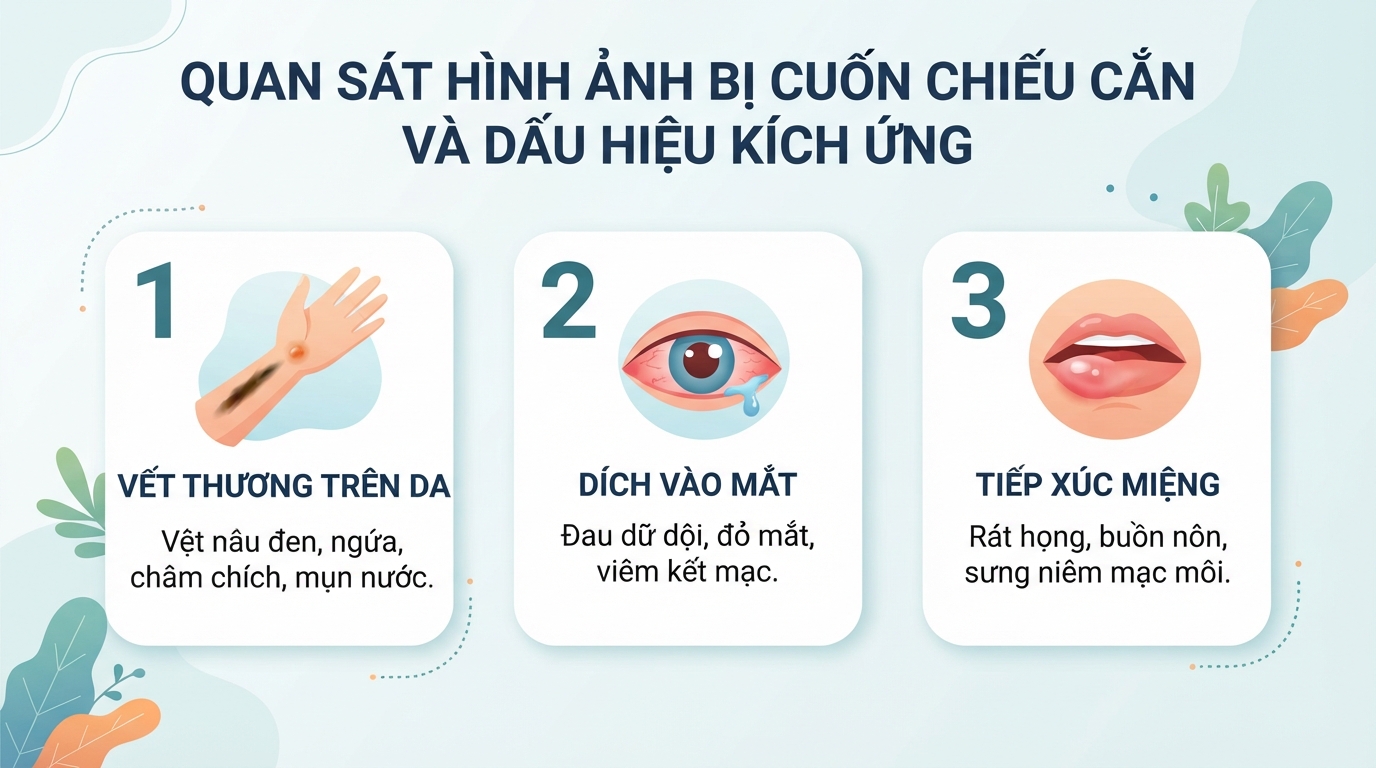 Con cuốn chiếu có độc không? Cách xử lý khi bị cắn đúng cách tại nhà