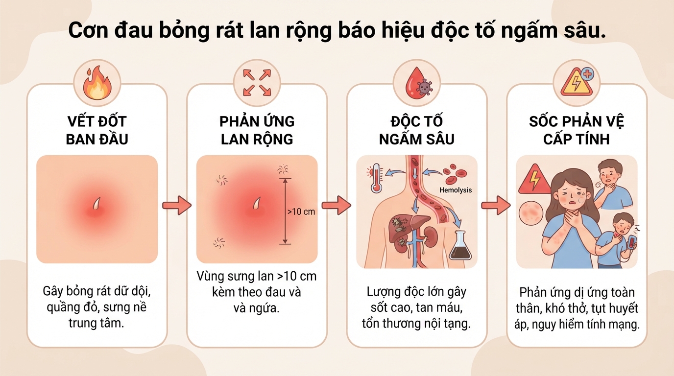 Bị ong bắp cày đốt có độc không? Cách sơ cứu an toàn