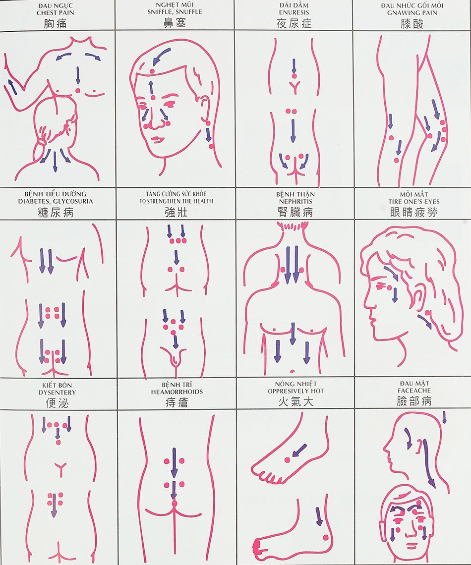 các huyệt đạo cần thiết cho giác hơi